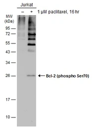 Anti-Bcl-2 (phospho Ser70) antibody used in Western Blot (WB). GTX129653