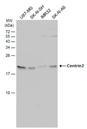 Anti-Centrin 2 antibody used in Western Blot (WB). GTX129709