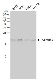 Anti-Centrin 2 antibody used in Western Blot (WB). GTX129709
