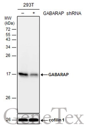 Anti-GABARAP antibody used in Western Blot (WB). GTX129710