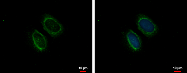 Anti-GABARAP antibody used in Immunocytochemistry/ Immunofluorescence (ICC/IF). GTX129710