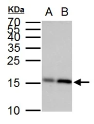 Anti-GABARAP antibody used in Western Blot (WB). GTX129710