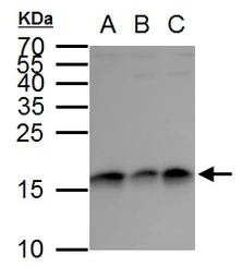 Anti-GABARAP antibody used in Western Blot (WB). GTX129710