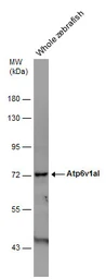 Anti-Atp6v1al antibody used in Western Blot (WB). GTX129736