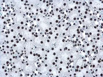 Anti-Histone H3K27me3 (Tri-methyl Lys27) antibody used in IHC (Paraffin sections) (IHC-P). GTX129774