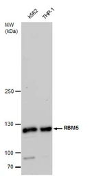 Anti-RBM5 antibody used in Western Blot (WB). GTX129783