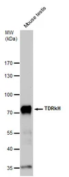 Anti-TDRKH antibody used in Western Blot (WB). GTX129795