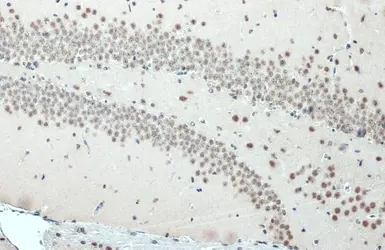 Anti-SNRPE antibody used in IHC (Paraffin sections) (IHC-P). GTX129801