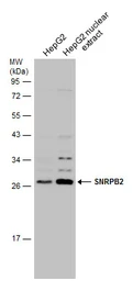 Anti-SNRPB2 antibody used in Western Blot (WB). GTX129802