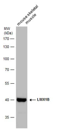 Anti-LMX1B antibody used in Western Blot (WB). GTX129831