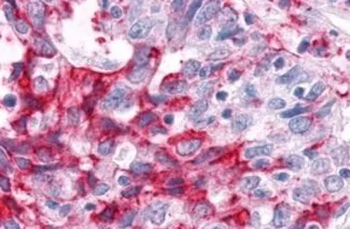 Anti-ERR alpha antibody used in IHC (Paraffin sections) (IHC-P). GTX12984