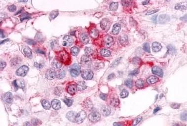Anti-ERR alpha antibody used in IHC (Paraffin sections) (IHC-P). GTX12984