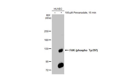 Anti-FAK (phospho Tyr397) antibody used in Western Blot (WB). GTX129840
