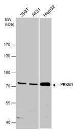 Anti-cGK1 antibody used in Western Blot (WB). GTX129845
