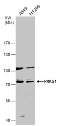 Anti-cGK1 antibody used in Western Blot (WB). GTX129845