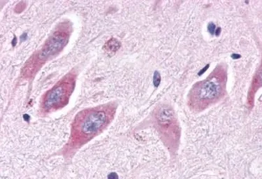 Anti-ERR alpha antibody used in IHC (Paraffin sections) (IHC-P). GTX12985