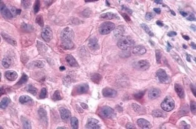 Anti-ERR alpha antibody used in IHC (Paraffin sections) (IHC-P). GTX12985