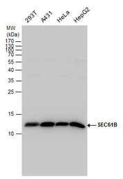 Anti-SEC61B antibody used in Western Blot (WB). GTX129852
