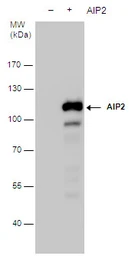 Anti-AIP2 antibody used in Western Blot (WB). GTX129863