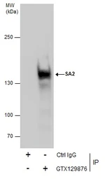 Anti-SA2 antibody used in Immunoprecipitation (IP). GTX129876