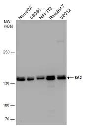 Anti-SA2 antibody used in Western Blot (WB). GTX129876