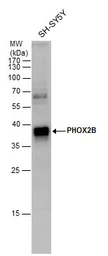 Anti-PHOX2B antibody used in Western Blot (WB). GTX129908