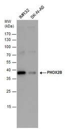 Anti-PHOX2B antibody used in Western Blot (WB). GTX129908