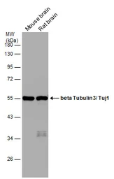 Anti-beta Tubulin 3/ Tuj1 antibody used in Western Blot (WB). GTX129913