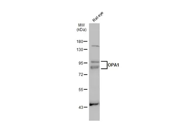 Anti-OPA1 antibody used in Western Blot (WB). GTX129917