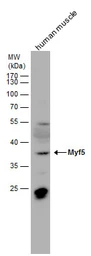 Anti-MYF5 antibody used in Western Blot (WB). GTX129925