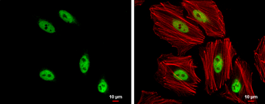 Anti-SOX8 antibody used in Immunocytochemistry/ Immunofluorescence (ICC/IF). GTX129949