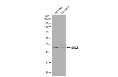 Anti-SOX8 antibody used in Western Blot (WB). GTX129949