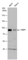 Anti-TAP1 antibody used in Western Blot (WB). GTX129963