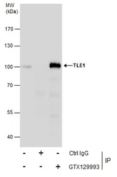 Anti-TLE1 antibody used in Immunoprecipitation (IP). GTX129993
