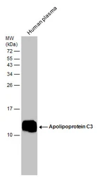 Anti-Apolipoprotein CIII antibody used in Western Blot (WB). GTX129994