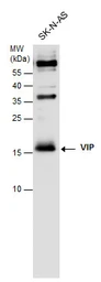 Anti-VIP antibody used in Western Blot (WB). GTX129997