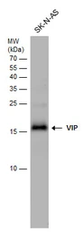 Anti-VIP antibody used in Western Blot (WB). GTX129999