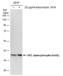 Anti-eIF2 alpha (phospho Ser51) antibody used in Western Blot (WB). GTX130006