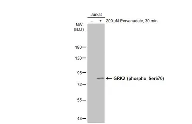 Anti-GRK2 (phospho Ser670) antibody used in Western Blot (WB). GTX130007