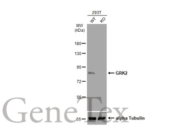 Anti-GRK2 antibody used in Western Blot (WB). GTX130012