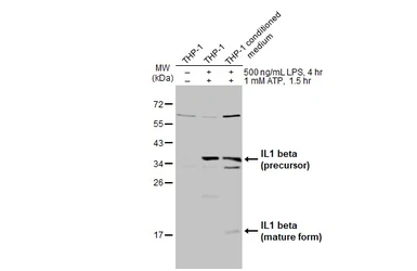 Anti-IL1 beta antibody used in Western Blot (WB). GTX130021