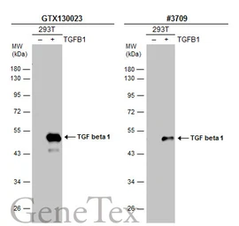Anti-TGF beta 1 antibody used in Western Blot (WB). GTX130023