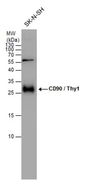 Anti-CD90 antibody used in Western Blot (WB). GTX130047