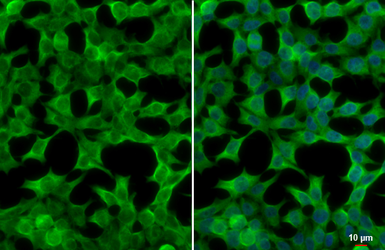 Anti-CSDA antibody used in Immunocytochemistry/ Immunofluorescence (ICC/IF). GTX130052