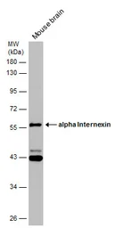 Anti-alpha Internexin antibody used in Western Blot (WB). GTX130053