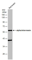 Anti-alpha Internexin antibody used in Western Blot (WB). GTX130053