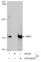 Anti-SMC2 antibody used in Immunoprecipitation (IP). GTX130078