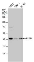 Anti-IL12B / IL12 p40 antibody used in Western Blot (WB). GTX130093
