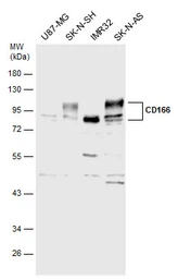 Anti-CD166 antibody used in Western Blot (WB). GTX130098