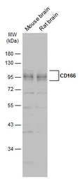 Anti-CD166 antibody used in Western Blot (WB). GTX130098